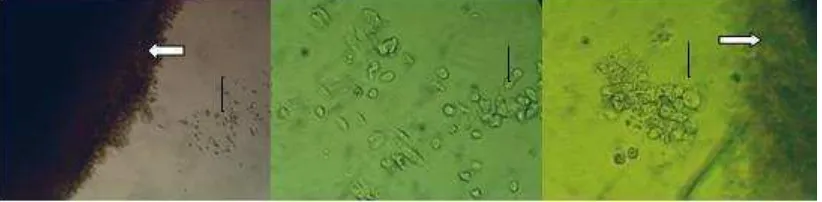 Gambar 2.3 Isolasi dari sel punca mesenkimal Wharton’s Jelly ( Puranik dkk., 2012) 