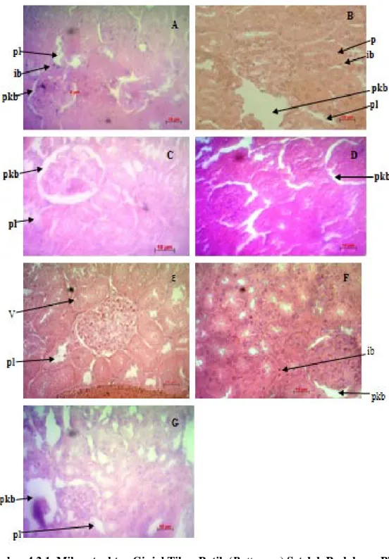 Gambar 4.2.1. Mikrostruktur Ginjal Tikus Putih (Rattus sp.) Setelah Perlakuan Pb  dan Pb+Kitosan Dengan Konsentrasi Berbeda