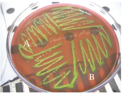 Gambar  2.2  :  Koloni  Escherichia  coli  pada  media  LEMB  (Levine’s  Eosin 