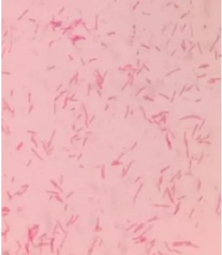 Gambar 2.2 Bakteri Shigella dysentriae   Sumber: (Zakwan et al., 2018) 