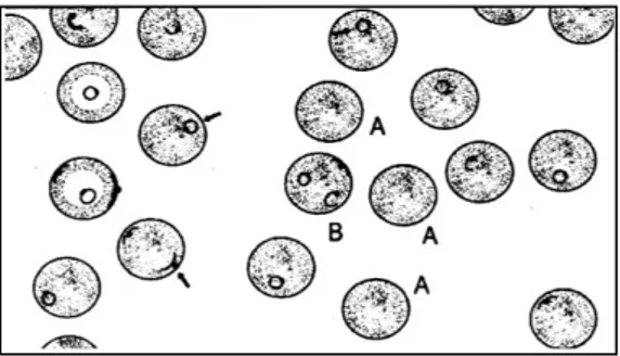 Gambar 1.7. Bentuk cincin dari tropozoit Plasmodium falciparum  (Pratomo Hurip, 1985)