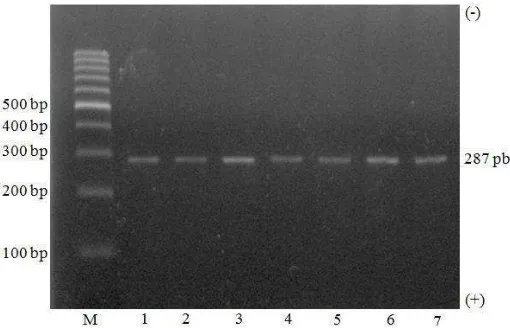 Gambar 6  Hasil amplifikasi gen SLC35A3 pada gel agarose 1.5%, menghasilkan  pita DNA berukuran 287 pb