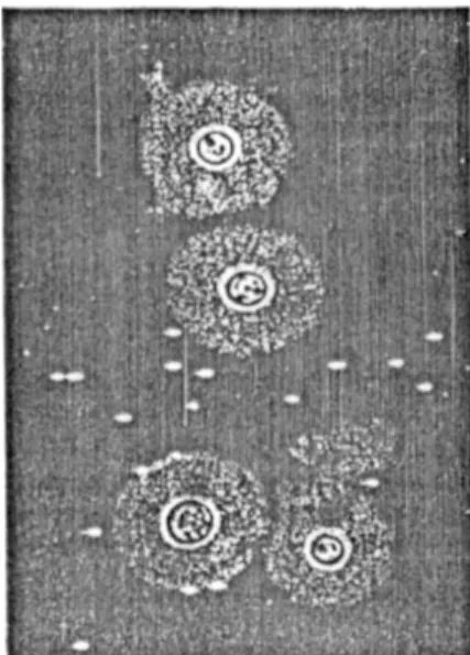Gambar 8.8. Kapsul yang terbentuk pada                                              sel   fungi Cryptococcus neoformatis  (sumber: Murray, et.all.,1994) 