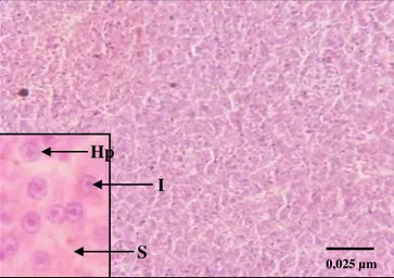 Gambar  2.  Mikrograf  struktur  hati  ikan  baung  (Mystus  nemurus)  normal  (Kn)  (HE,  400X) Keterangan : Hepatosit (Hp), Inti Sel (I) dan Sinusoid (S)