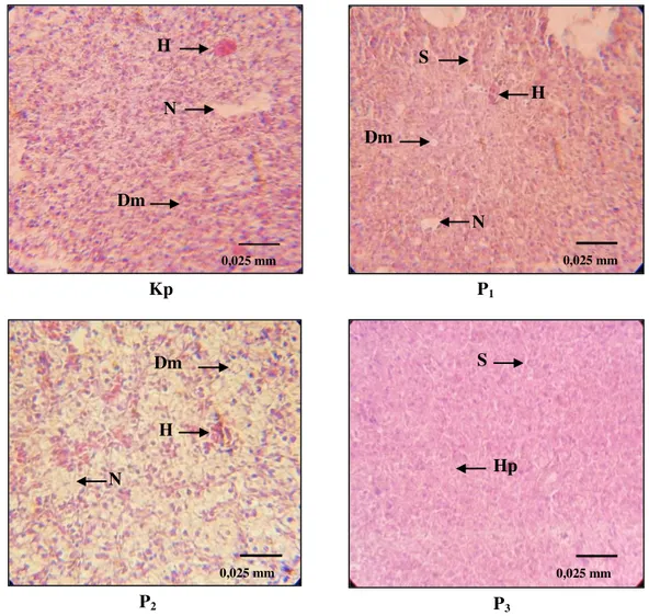 Gambar  3.  Mikrograf  struktur  hati  ikan  baung  (Mystus  nemurus)  (Kp ,  P 1,  P 2  dan P 3 )  yang  diinfeksi  bakteri  Aeromonas  hydrophila  (HE,  400X)  Keterangan  :  Hepatosit  (Hp),  Sinusoid  (S),  Hemoragi  (H),  Nekrosis  (N),  dan  Degenera