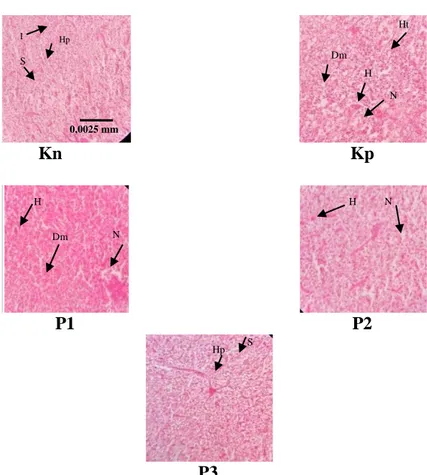 Gambar 2 . Fotomikrogaf struktur hati ikan jambal siam (Pangasius      