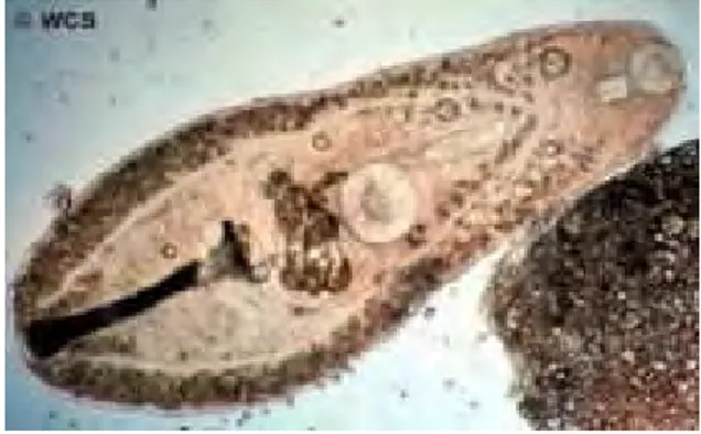 Gambar 2. Helicometra spp., suatu digenea opecoelid pada ikan (Anonim  2008) 