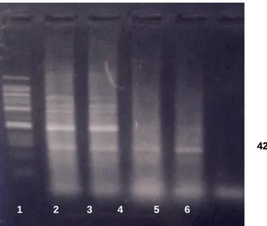 Gambar 5.  Hasil  deteksi  VNN  dengan  PCR  setelah  uji  tantang  dengan  VNN  pada  benih  ikan  kerapu  bebek,  Cromileptes  altivelis  yang  ditingkatkan  respon  imun  non-spesifiknya  dengan  pemberian  bakterin  (1  =  marker;  2  =  perlakuan  A; 