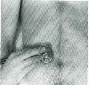 Gambar 2. Auskultasi abdomen untuk memeriksa bising usus 