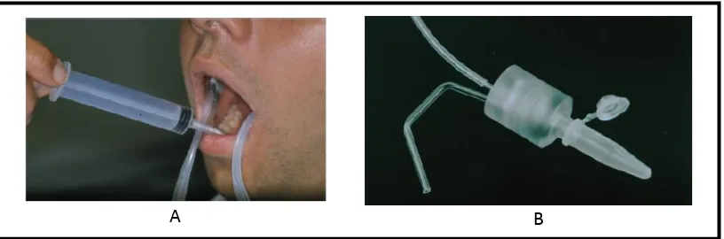 Gambar 1.  Pengumpulan saliva individu kelenjar parotid. A= Alat cup Lashley, B= Posisi peletakan alat diatas orifisi kelenjar parotid (duktus Stensen)27  