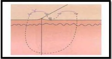 Gambar 7. Vertical Mattress Suture14 