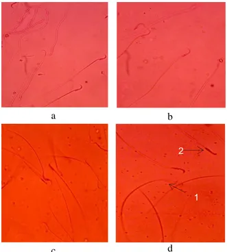 Gambar  1.  Pengamatan  sperma  pada  kelompok  perlakuan  obat  nyamuk  semprot  dan  bakar