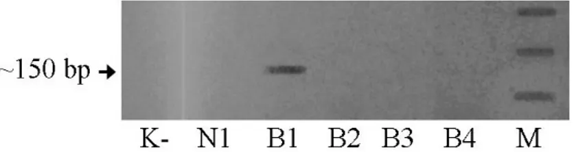 Gambar  2  Produk  Hasil  PCR  DNA  Genomik  dari  Sampel  Pasien  Didiagnosis  Terinfeksi  HPV         Menggunakan Primer GP5(+) dan GP6(+)