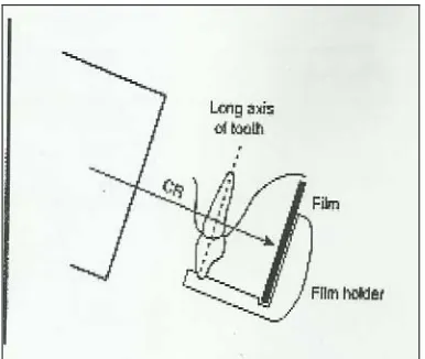 Gambar 4. Teknik Paralleling22  