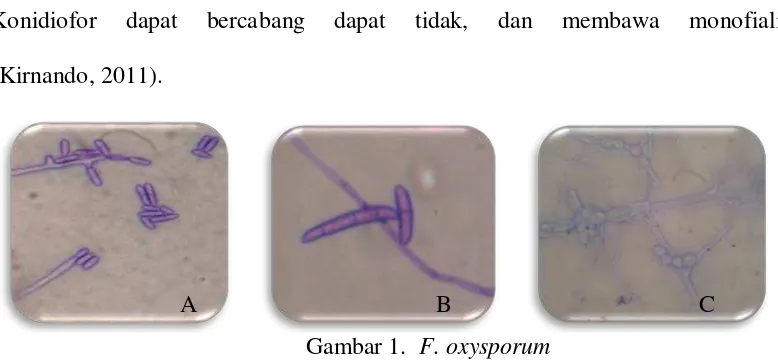 Gambar 1.    F. oxysporum 