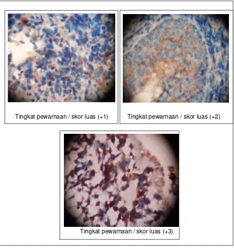 Gambar 7. Penilaian tingkat pewarnaan / skor luas imunohistokimia COX-2 