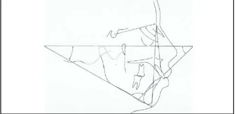 Gambar 6. FMA ( Frankfort Mandibular Angle ), FMIA (Frankfort Mandibular Incisor Angle), IMPA (Incisor Mandibular Plane Angle ).7  