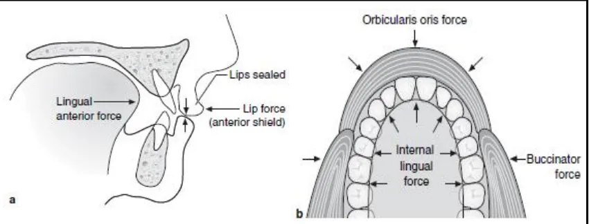 Gambar 1. Posisi istirahat lidah menyebabkan tekanan internal dan eksternal terhadap Gigi-geligi menjadi seimbang sehingga memicu perkembangan normal regio dental alveolar.23 