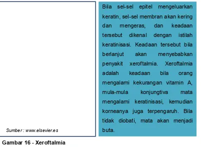 Gambar 16 - Xeroftalmia 