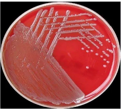 Gambar 3. Isolat Acinetobacter baumannii (diameter koloni 0,5-2 mm) (Ajao et al., 2011) 