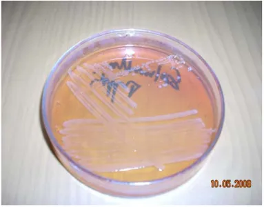 Gambar 2. Salmonella typhii setelah kultur 24 jam dalam agar Mac.Conkey (foto diambil dari  laboratorium Mikrobologi FK UNDIP) 