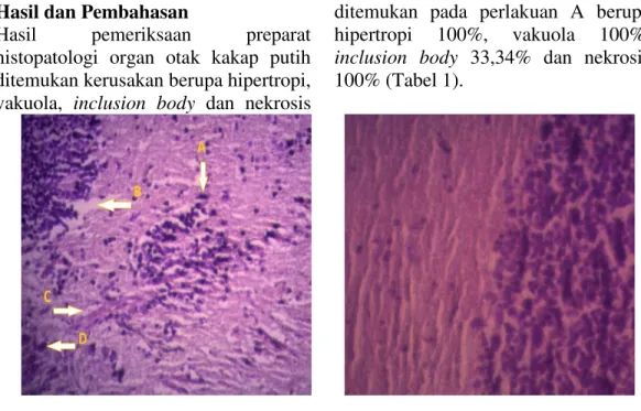 Gambar  1.  Preparat  histopatologi  otak  kakap  putih  (Lates  calcarifer).  Preparat  organ otak yang diinjeksi VNN perlakuan A (kiri), preparat organ otak  normal  (kanan)