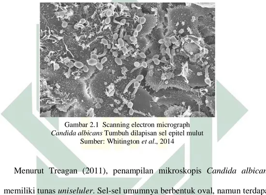 Gambar 2.1  Scanning electron micrograph  Candida albicans Tumbuh dilapisan sel epitel mulut 