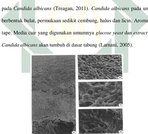 Gambar 2.3 Smooth Koloni Candida  albicans di SEM 