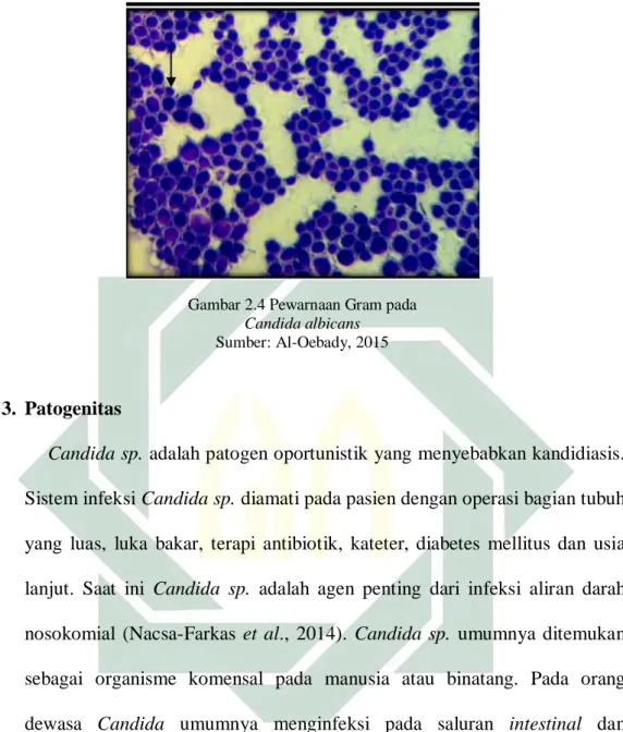 Gambar 2.4 Pewarnaan Gram pada  Candida albicans 