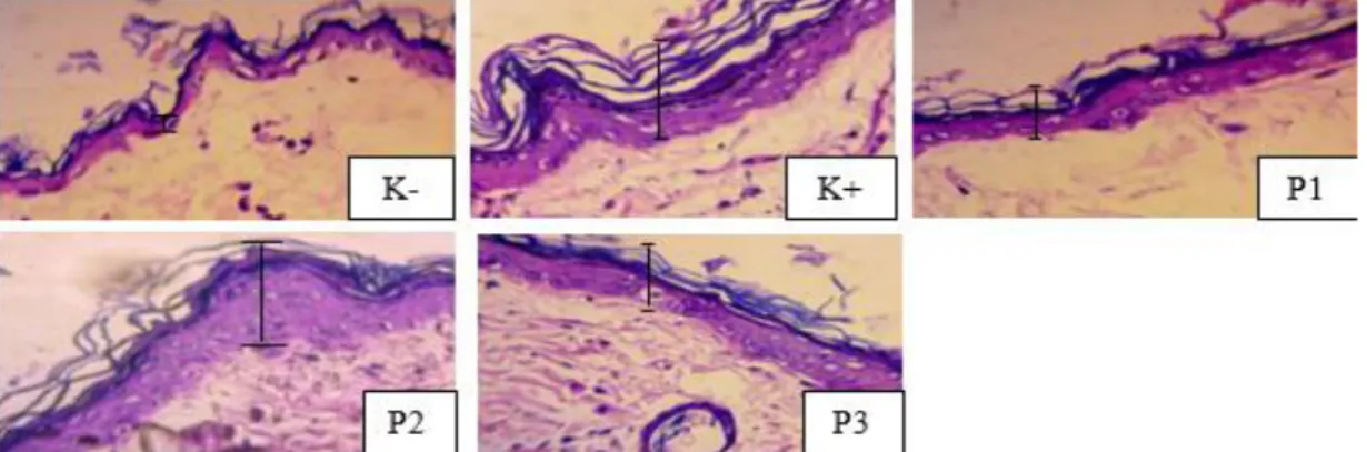 Gambar 4.3  Gambaran Histologi Kulit (Ketebalan Epitel) yang terpapar sinar UV. K+ 