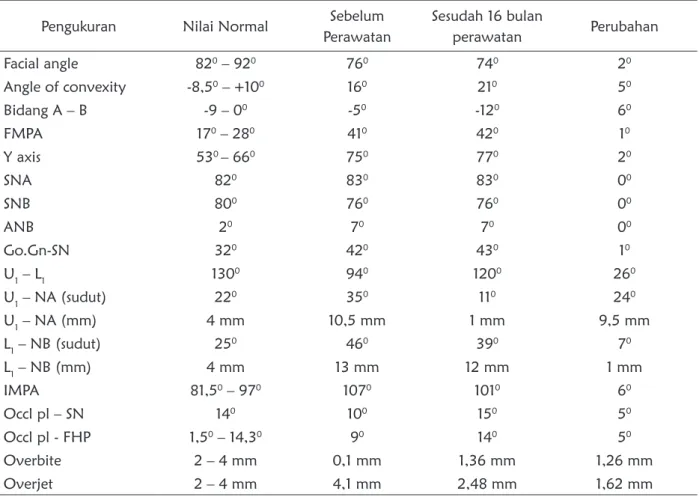 Tabel 1. Pengukuran sefalometri sebelum dan sesudah perawatan selama 16 bulan