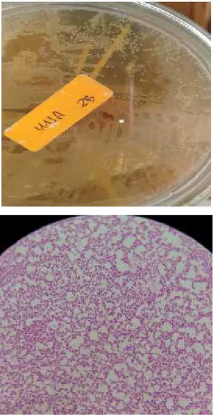 Gambar 6. Identifikasi Bakteri Staphylococcus aureus