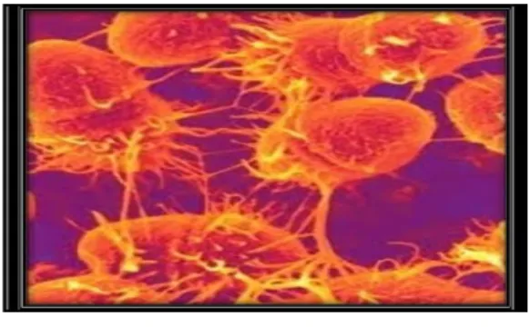 Gambar 2 :Enterococcus faecalis  Sumber :  Bacterianphoto.com 