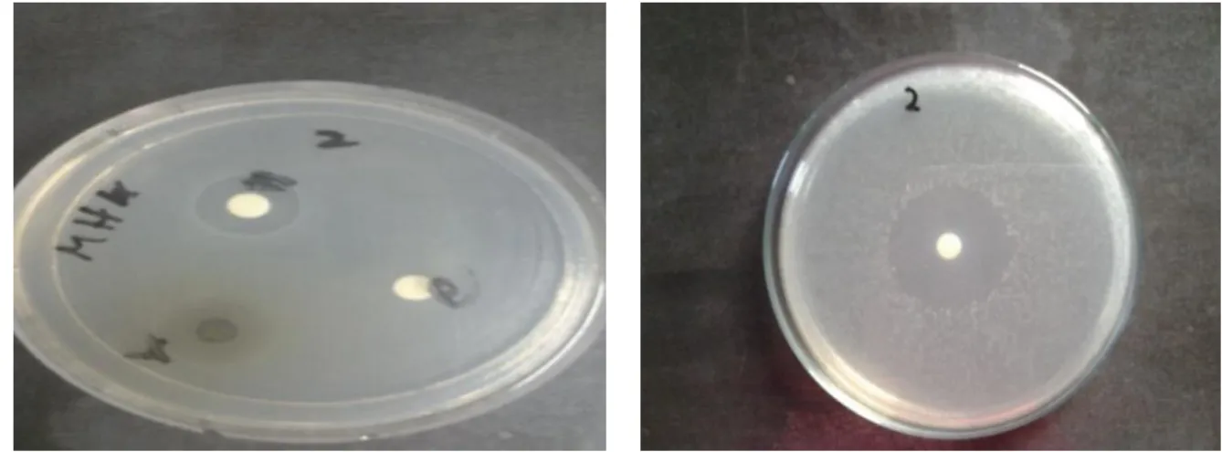 Gambar B: Hasil uji daya hambat Klorheksidin 0,2% Terhadap bakteri  Enterococcus faecalis 