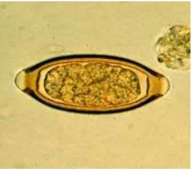 Gambar 7. Telur T. Trichiura dengan perbesaran 100x.  (Prianto, J., 
