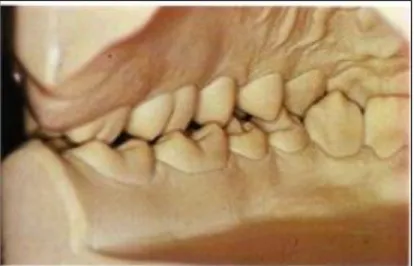 Gambar 5. Fungsi atau oklusi gigi yang ideal (Aspek lingual). 45 