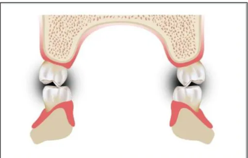 Gambar 6. Hubungan ideal molar, pandangan melintang. 46