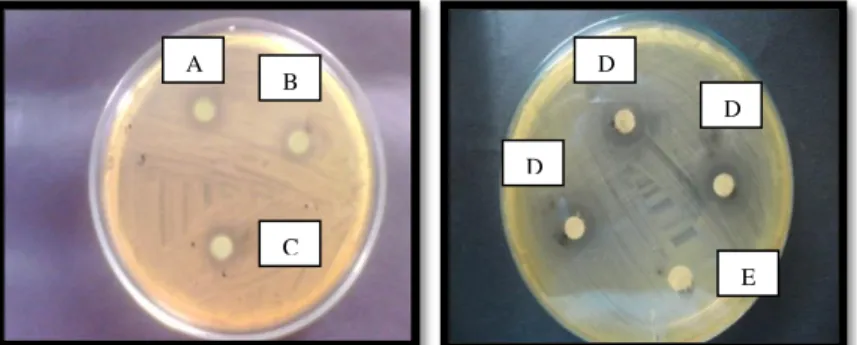 Gambar  2.  Uji  Efektivitas  sediaan  sabun  mandi  cair  Minyak  atsiri  (A)  F1  (0,05%) ; (B) F2 (0,15%) ; (C) F3 (0.25%) ; (D) Kontrol positif; (E) Kontrol  Negatif  A  B C  D  E D D 