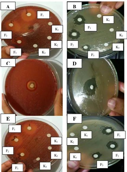 Gambar 2. Hasil Uji Efektivitas Antibakteri. 