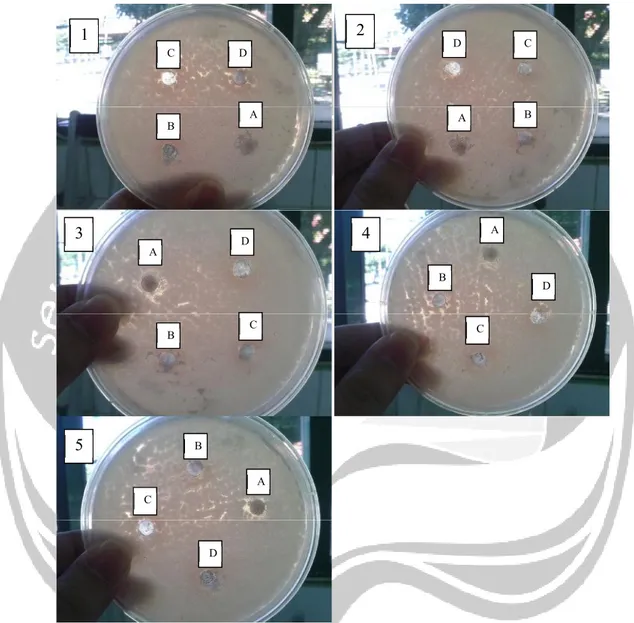 Gambar 21. Hasil zona hambat kontrol positif dan negatif terhadap bakteri Bacillus cereus.