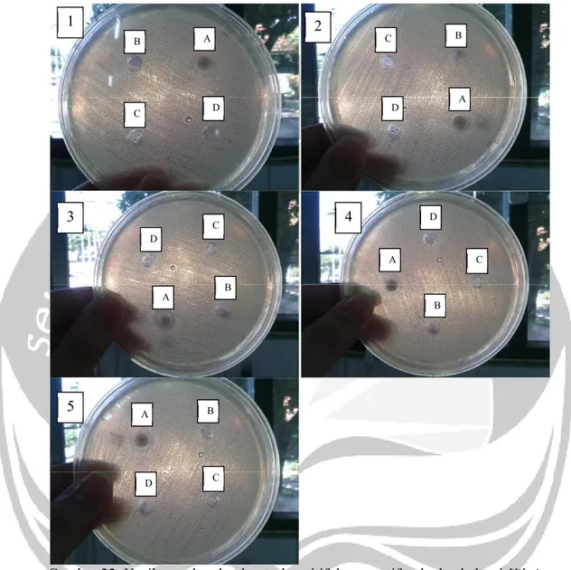 Gambar 22. Hasil zona hambat kontrol positif dan negatif terhadap bakteri Vibrio cholerae.