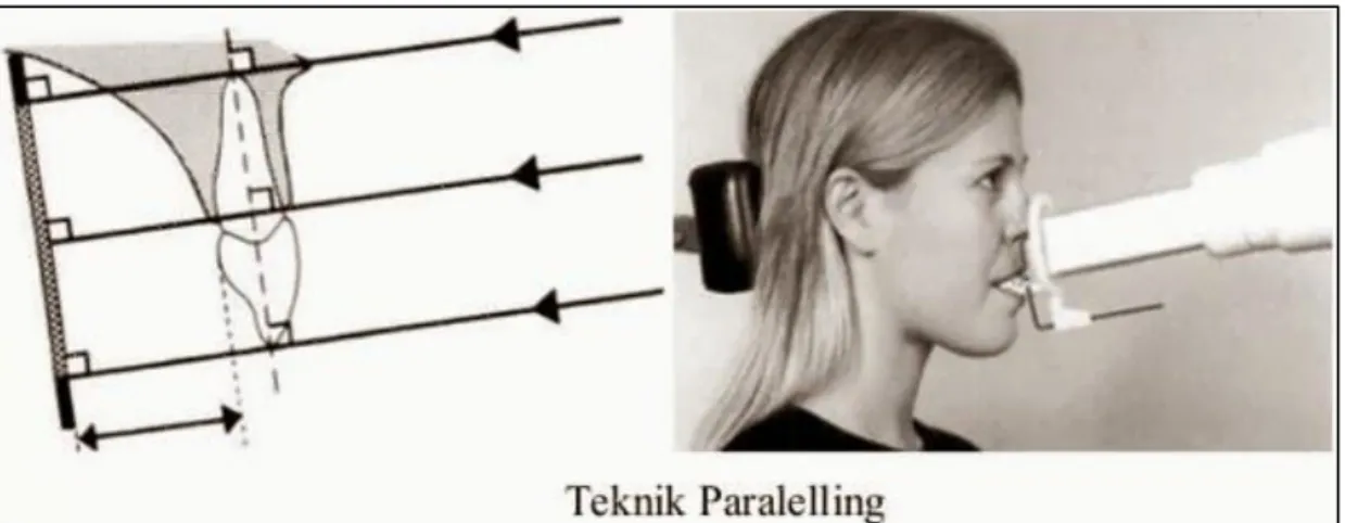 Gambar 6. Radiografi Periapikal Teknik Paralel. 