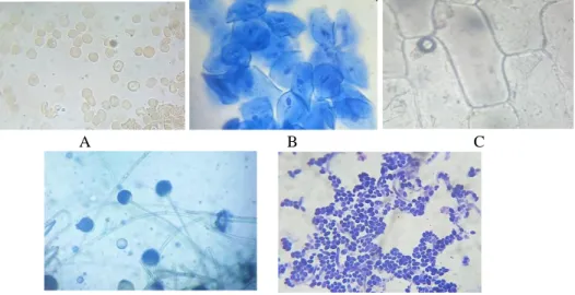 Gambar  3.  Hasil  pembuatan  preparat  segar  dari  kegiatan  PPM  mengenai  pembuatan  preparat  yaitu  preparat  eritrosit  (A),  preparat  sel  epitel mukosa pipih (B) preparat sel tumbuhan (C), dan preparat  hifa jamur (D) preparat sel bakteri (E) den