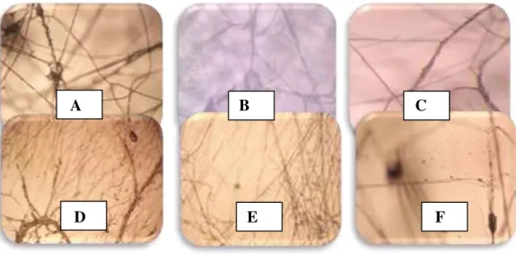 Gambar 1:    Interaksi  antara  jamur  endofit  dan  F. oxysporum. (A)  dan (B)  hifa endofit                           mengkait   hifa   patogen (400x), (C) hifa  endofit melilit hifa patogen   (400x),   