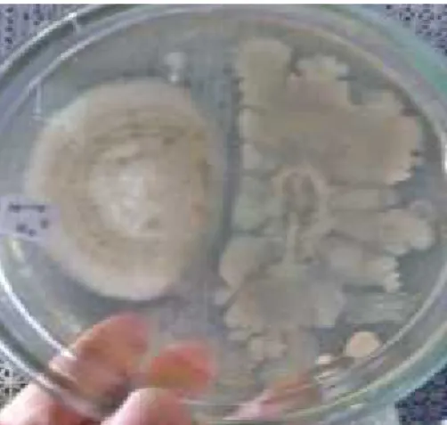 Gambar  1 menunjukkan zona bening antara P. oryzae dengan isolat bakteri. Menurut Basha dan Ulaganathan (2002) menyatakan bahwa bakteri dapat menghasilkan enzim kitinase yang dapat melisis dinding sel patogen, dinding sel beberapa cendawan  patogen  dilapo