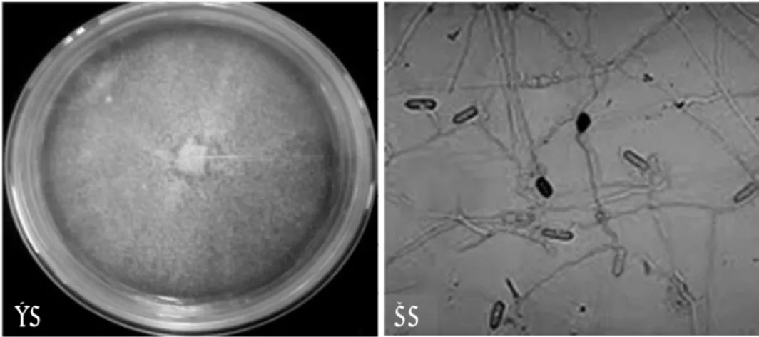 Gambar 1. (A) Koloni Colletotrichum sp. pada media PDA, dan (B) Hifa dan konidia Colletotrichum sp