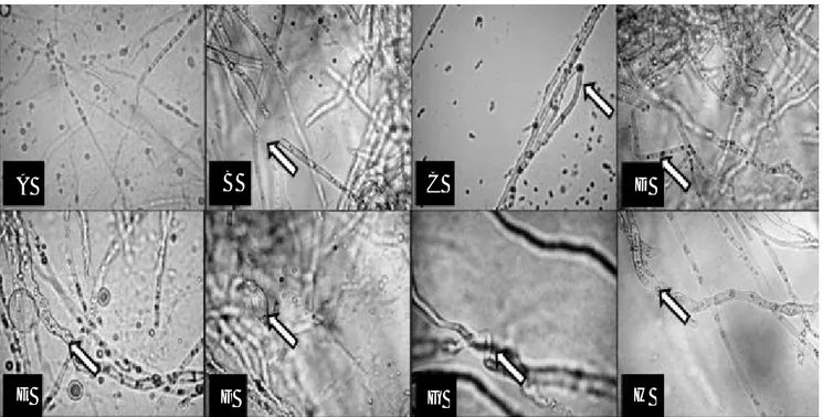 Gambar 4. Hifa abnormal Colletotrichum sp. disebabkan oleh isolat bakteri endofit setelah uji antagonis in vitro: (A) Normal, (B) Putus dan lisis oleh DS 01, (C)