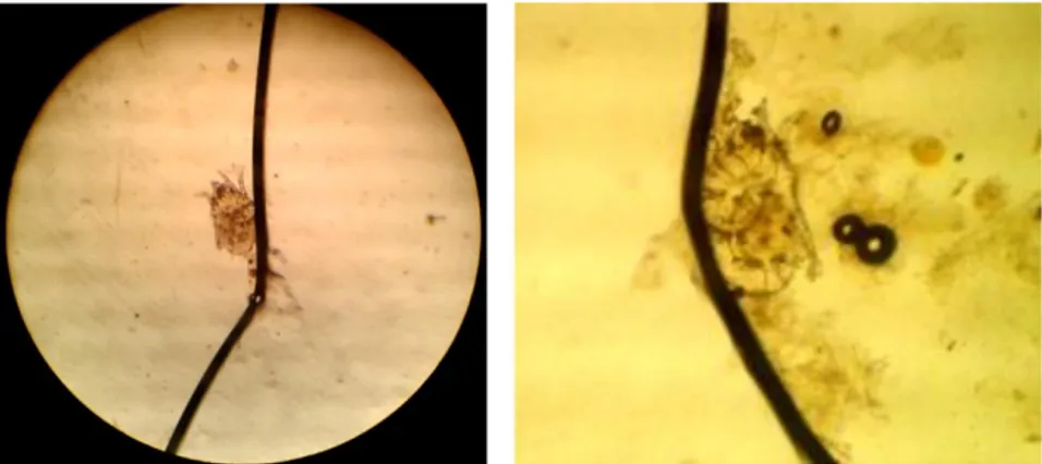 Gambar  4.1.  Hasil  pemeriksaan  mikroskopis  kerokan  kulit  kambing  dengan  pembesaran 100X 