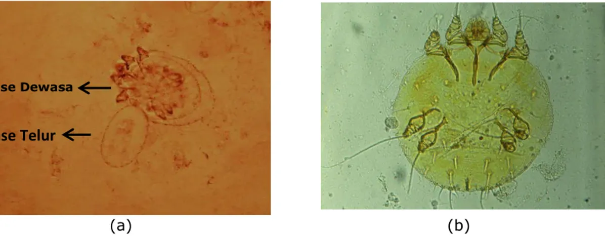 Gambar 4. Hasil pemeriksaan sampel secara mikroskopis pada kerokan  kulit marmut (a. Perbesaran 100X  dan  b Jantan perbesaran 200X)  2
