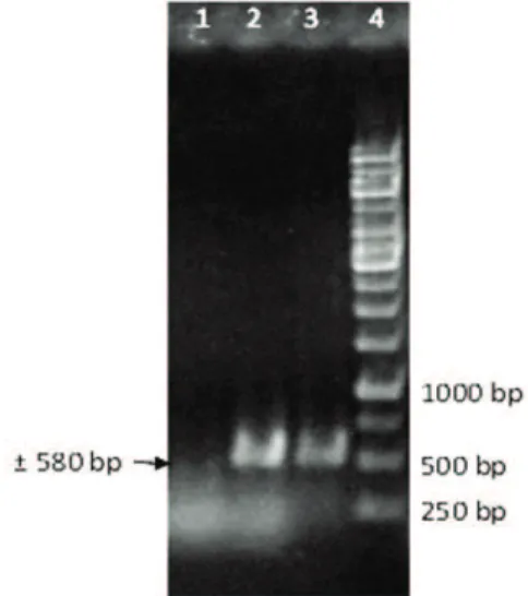 Gambar 2. Hasil identifikasi virus pada tanaman melon bergejala daun keriting dengan PCR, divisualisasi dengan gel agarose 1% (lajur 1: sampel tidak bergejala daun keriting (kontrol negatif); lajur 2: cabai terinfeksi Begomovirus (kontrol positif); lajur 3